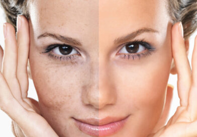 Como Aumentar o Colágeno e Rejuvenescer Sua Pele com Este Truque! 4 aumente o colageno e rejuvenezca scaled e1679378216933